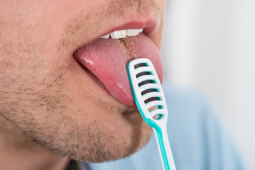 10 causas del mal aliento y cómo combatirlo - 10. Mala higiene de la lengua 