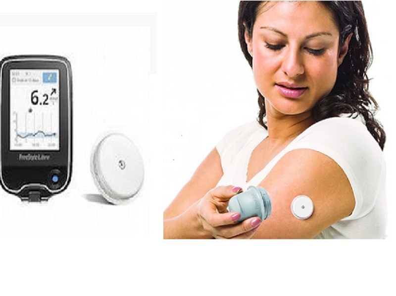 Egipto Faceta Itaca Diabetes: Aprueban el primer sensor que mide la glucosa sin pinchazos