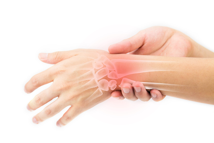 Artritis: conoce las propiedades de la Boswellia serrata - Artritis reumatoide
