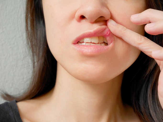 Tus labios pueden revelar enfermedades - De las partes más sensibles