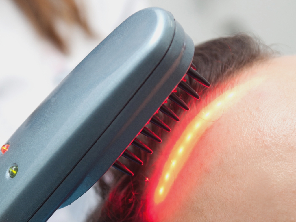 La verdad sobre los remedios para la caída del cabello - Láser de baja intensidad o terapia de luz