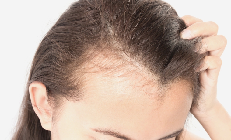La verdad sobre los remedios para la caída del cabello - Productos recetados