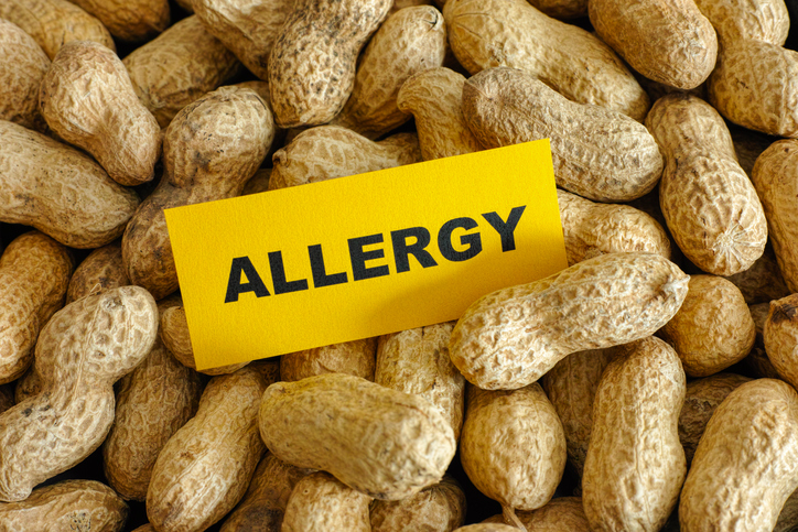 Las alergias alimentarias más comunes  - 3. Cacahuates o maní