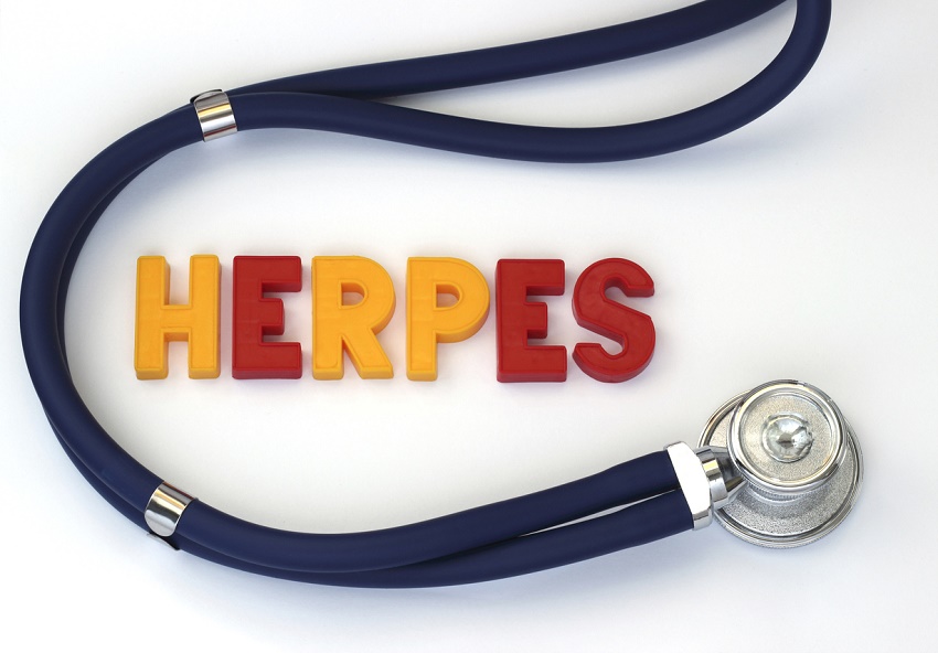 10 enfermedades que no tienen cura - 7. Herpes simple