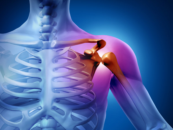 10 beneficios saludables del nopal - Para evitar osteoporosis