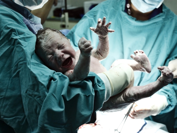 Bebés prematuros ¿cuál es el límite? - Avances de la ciencia