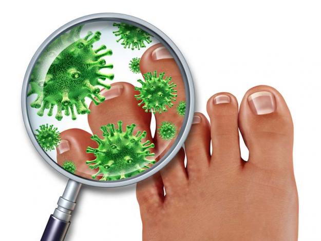 Sorprendentes usos del bicarbonato para la belleza y la salud - #11 Combatir hongos en los pies