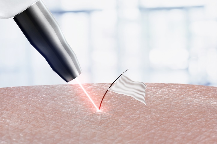 7 consejos médicos para depilar el vello púbico - Depilación láser de buena calidad