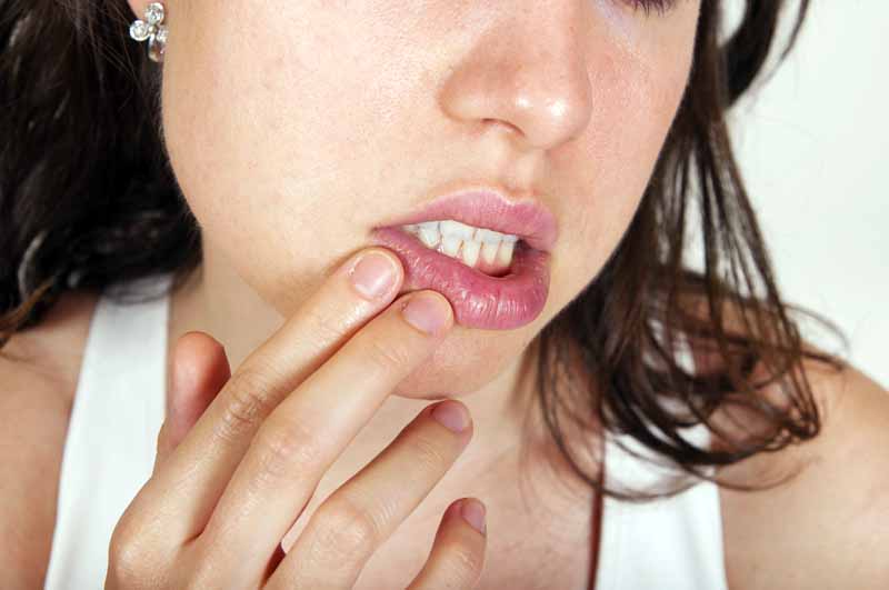 10 cosas que debes saber si tienes herpes - 10. El herpes bucal puede transformarse en herpes genital