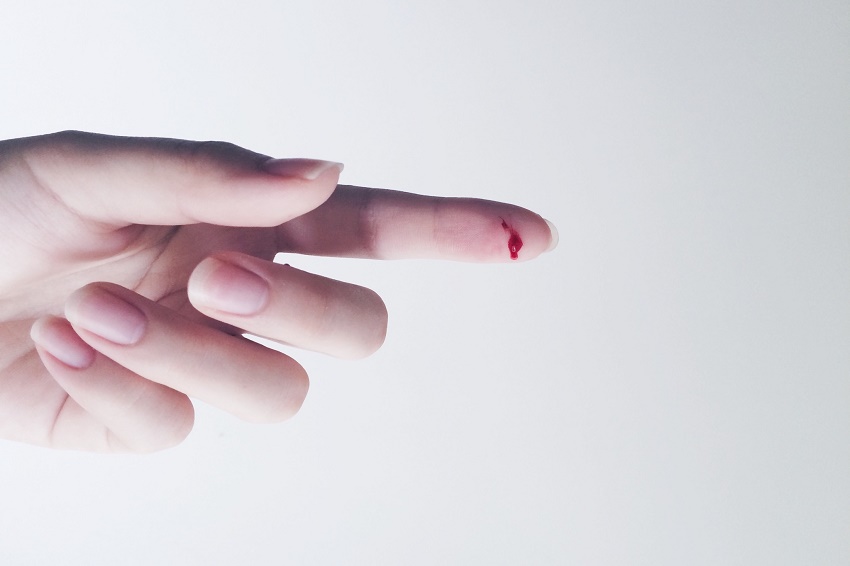 10 consejos de primeros auxilios para curar cortes y heridas - Cómo son las heridas