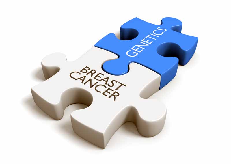 10 mitos acerca del cáncer de seno - Mito 2: Si soy BRCA1 o BRCA2 positivo, debería hacerme una mastectomía bilateral