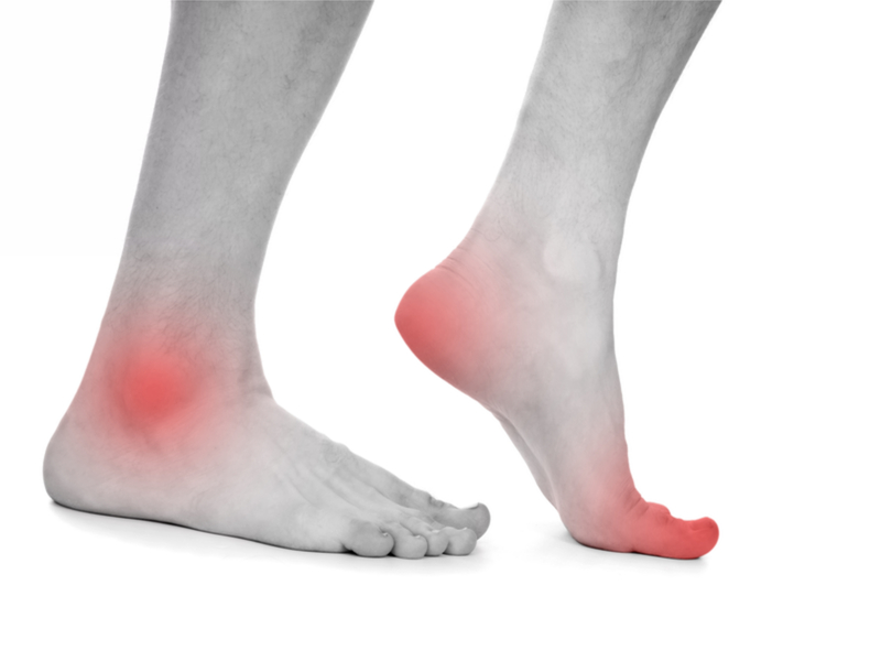 Artritis, lesiones y otros daños de los tacones altos - 1. Trampolín a la artritis