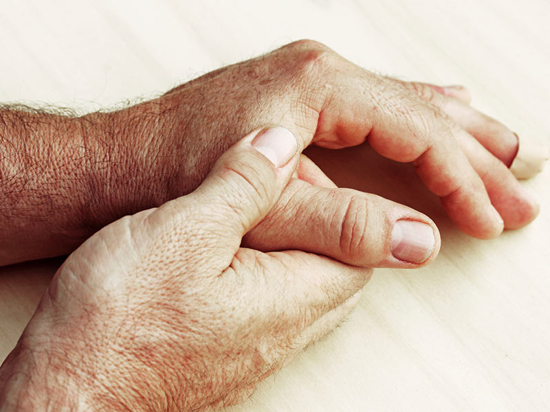 10 señales de alerta de la artritis - 2. Rigidez