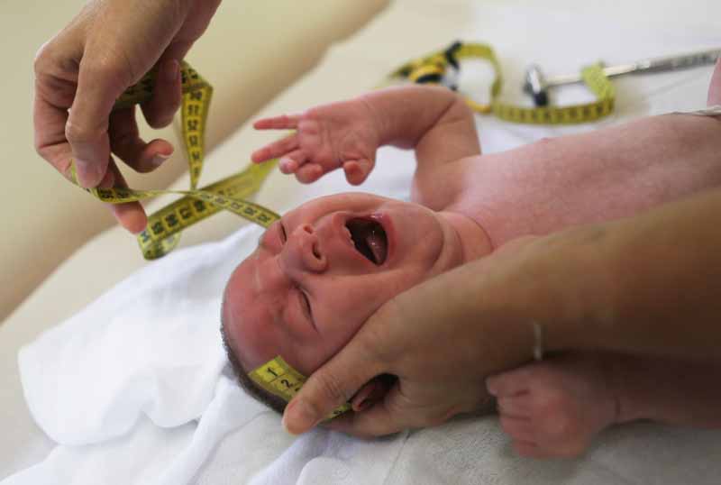 Virus del Zika y bebés con microcefalia: lo que debes saber - Microcefalia: causas y diagnóstico