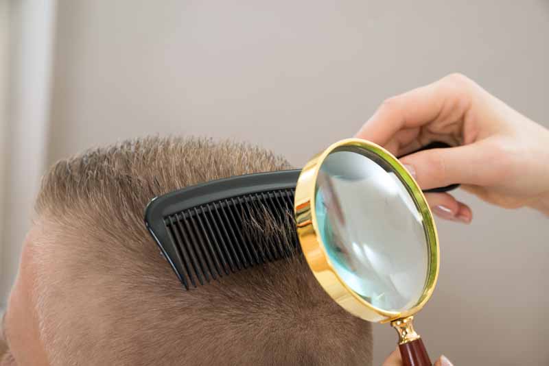 5 trucos simples para evitar la caída del cabello - 3. Consulta con tu médico antes de tomar un medicamento