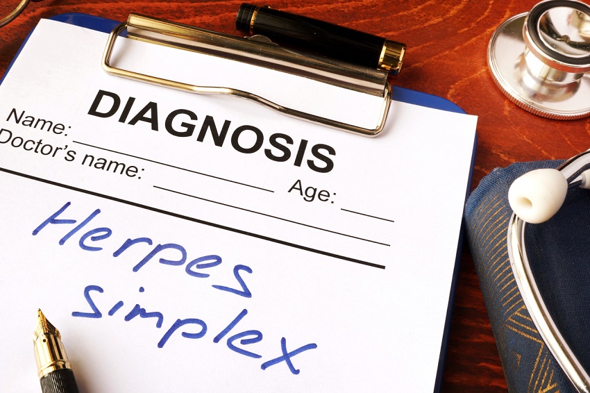Cuáles son los síntomas del Herpes - Qué tan frecuente es