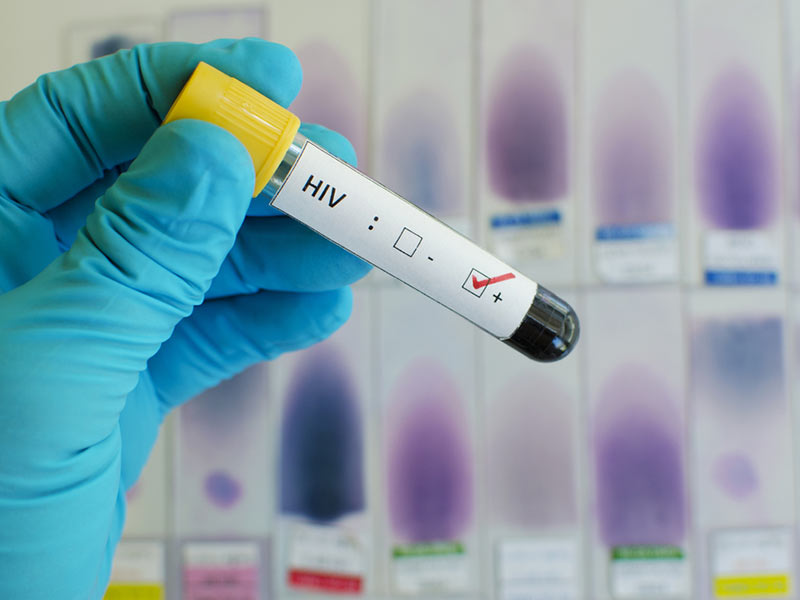Mitos y verdades sobre la donación de sangre - 7. Se puede contraer VIH de un donante
