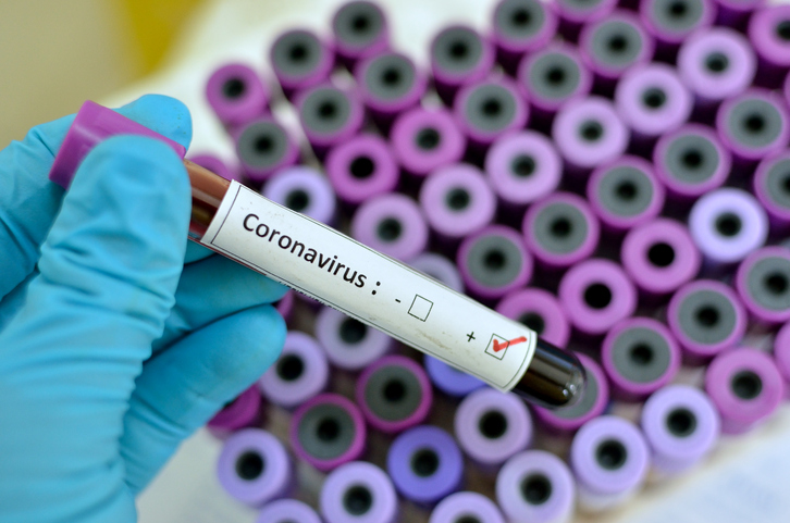 Congestión nasal, ¿es alergia, gripe o coronavirus? - COVID-19