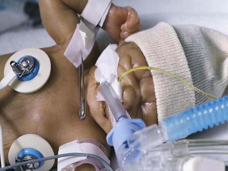 El Contacto Piel Con Piel Podría Mejorar La Supervivencia De Los Bebés Muy Prematuros 6415