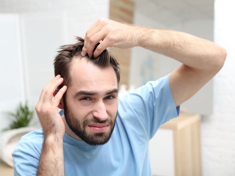 Toda La Verdad Sobre La Mejor Forma De Combatir La Pérdida Del Cabello En Los Hombres 5772