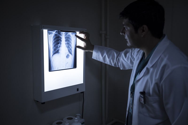 Los estadounidenses de origen mexicano, con más riesgo de cáncer de hígado